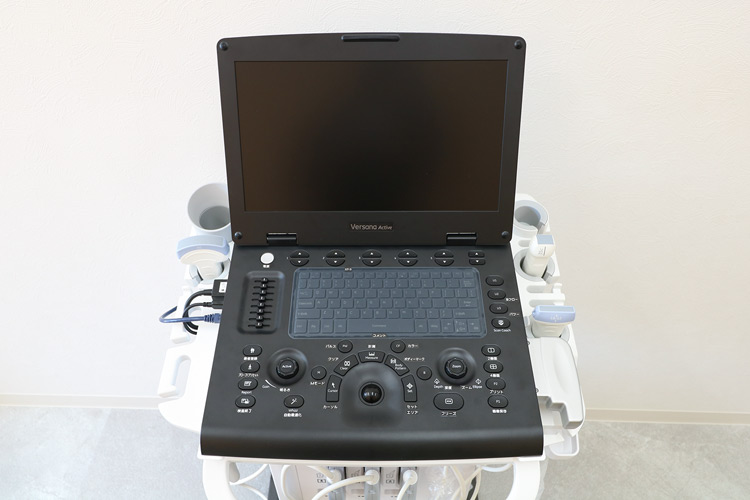 超音波診断装置